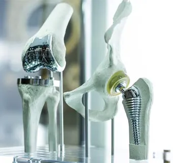 3D printet titanium knæimplantat til medicinsk og aerospace brug